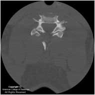 CT scan after a traumatic accident