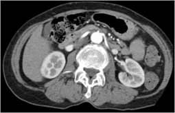 CT - internal body structures