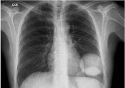 x-ray - internal body structures