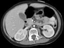 CT image