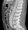 CT angiography image