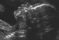 Ultrasound image