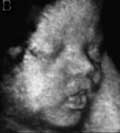 Ultrasound image