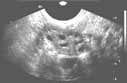 Ultrasound image