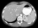 CT image