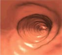 Virtual colonoscopy video