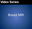 A series videos related to breast MRI